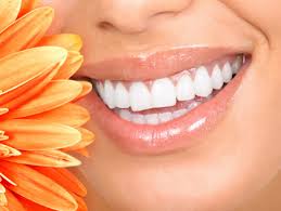 Whitening Carlsbad